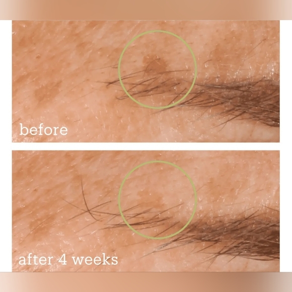 SkinFix🌎Resurface +Glycol Lactic Brightening Boost, 1.7oz. FULL SIZE NIB - Picture 2 of 6